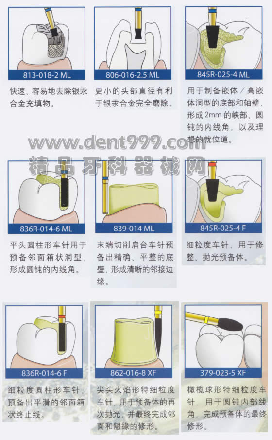 金霸王瓷贴面套装使用步骤