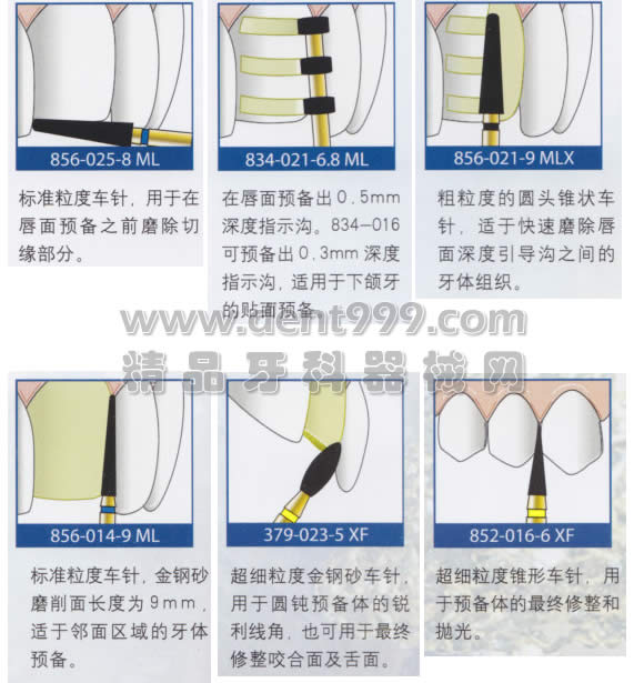 金霸王瓷贴面套装使用步骤