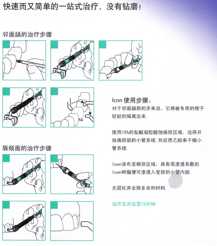 使用步骤 使用步骤