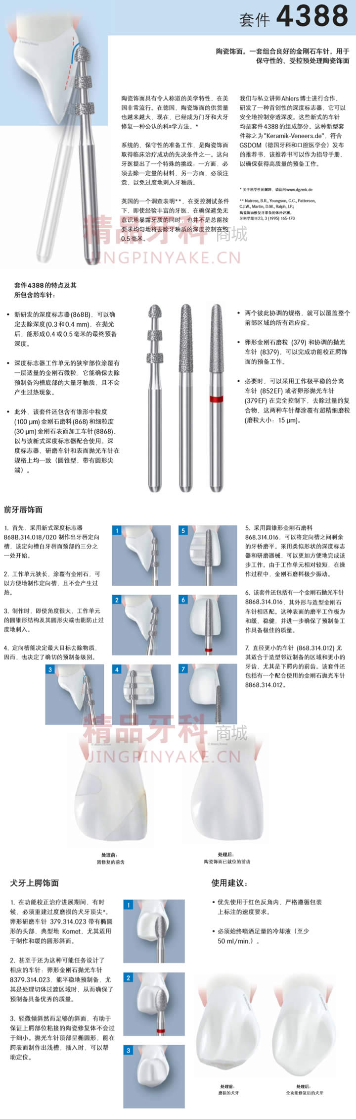 固美 瓷贴面预备套装 4388-2.jpg