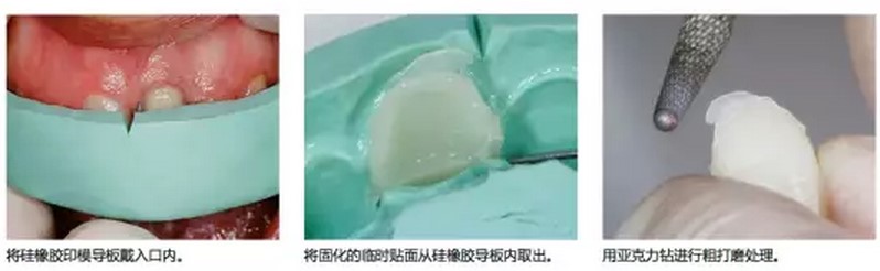 使用步骤 使用步骤