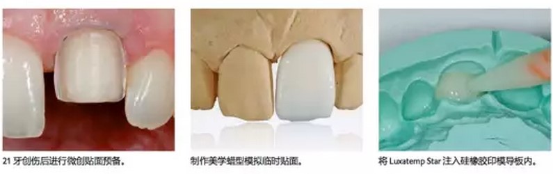 使用步骤 使用步骤