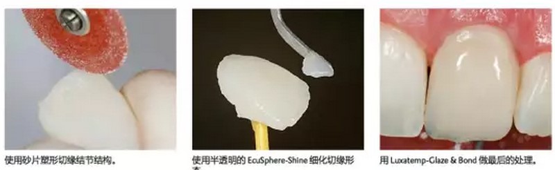 使用步骤 使用步骤