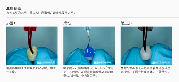 皓齿陶瓷酸蚀剂2.webp