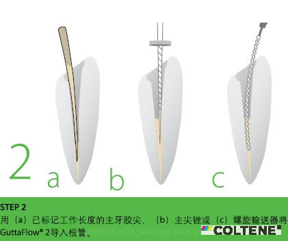 康特 GuttaFlow 2根管充填常温流动牙胶.jpg 康特 GuttaFlow 2根管充填常温流动牙胶.jpg
