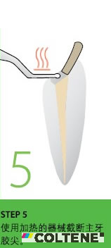 康特 GuttaFlow 2根管充填常温流动牙胶5.jpg 康特 GuttaFlow 2根管充填常温流动牙胶5.jpg