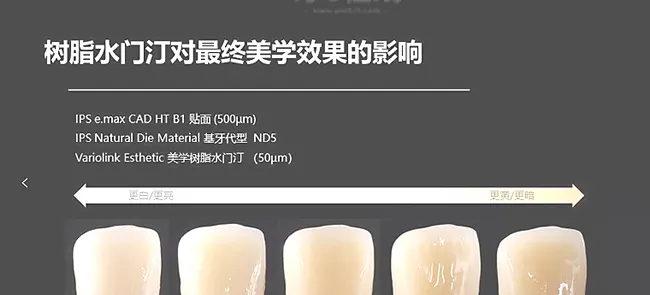义获嘉 Variolink Esthetic LC 牙科粘结剂