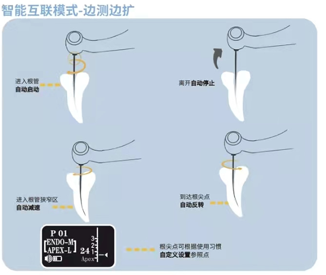 益锐 iRoot pro 根管治疗仪5.jpg