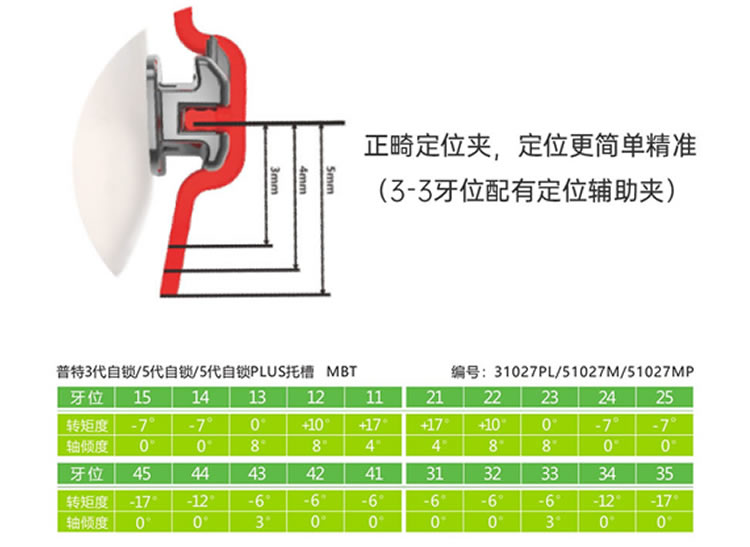 普特PT-5PLUS直丝弓五代金属被动自锁托槽_r3_c1.jpg