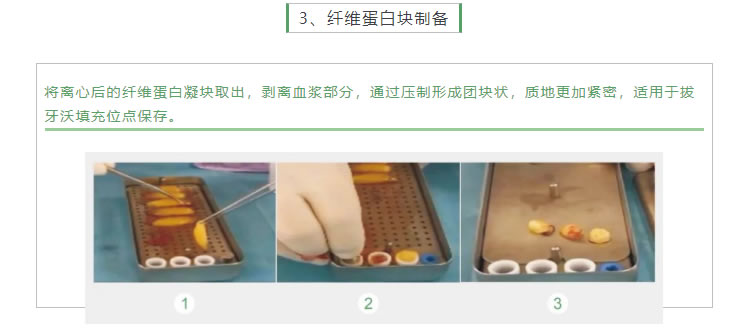 湘启 TD4E口腔专用离心机2_r5_c1.jpg