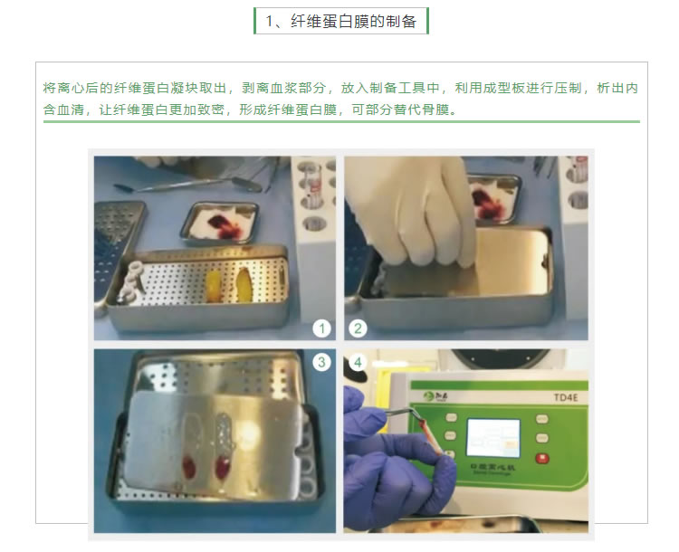 湘启 TD4E口腔专用离心机2_r3_c1.jpg