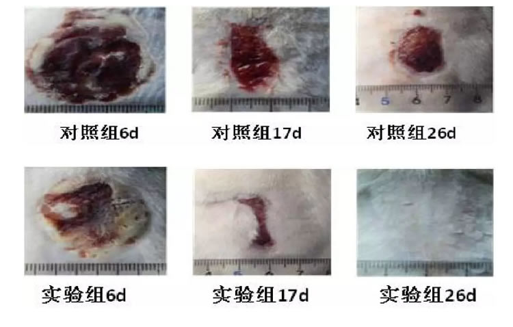 博益优 术益纱【可吸收止血生物膜】1_r4_c1.jpg 博益优 术益纱【可吸收止血生物膜】1_r4_c1.jpg