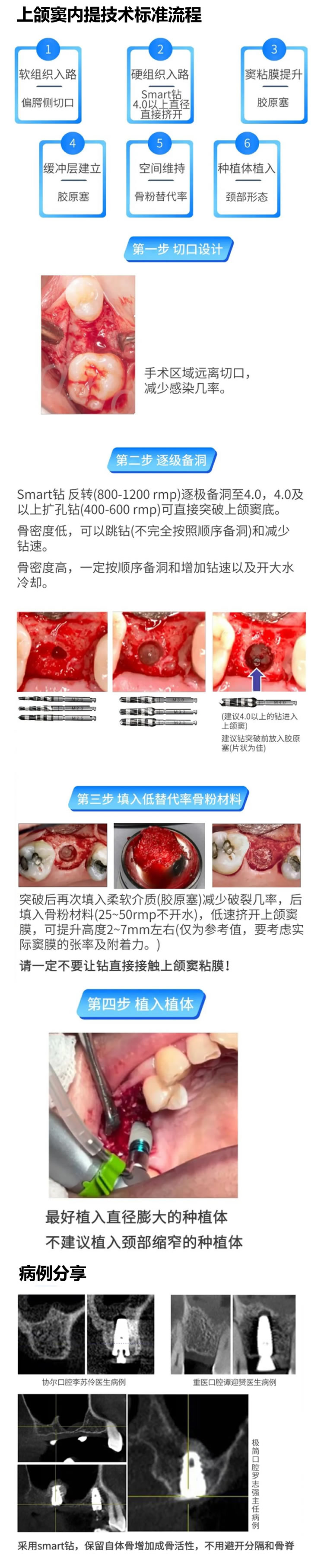 西科码  上颌窦套装1.jpg