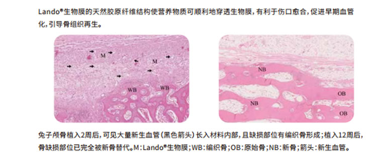 兰度 骨膜1_r5_c1.jpg