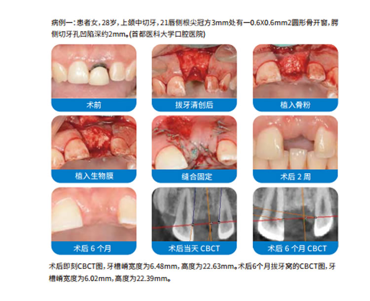 兰度 骨膜1_r10_c1.jpg 兰度 骨膜1_r10_c1.jpg