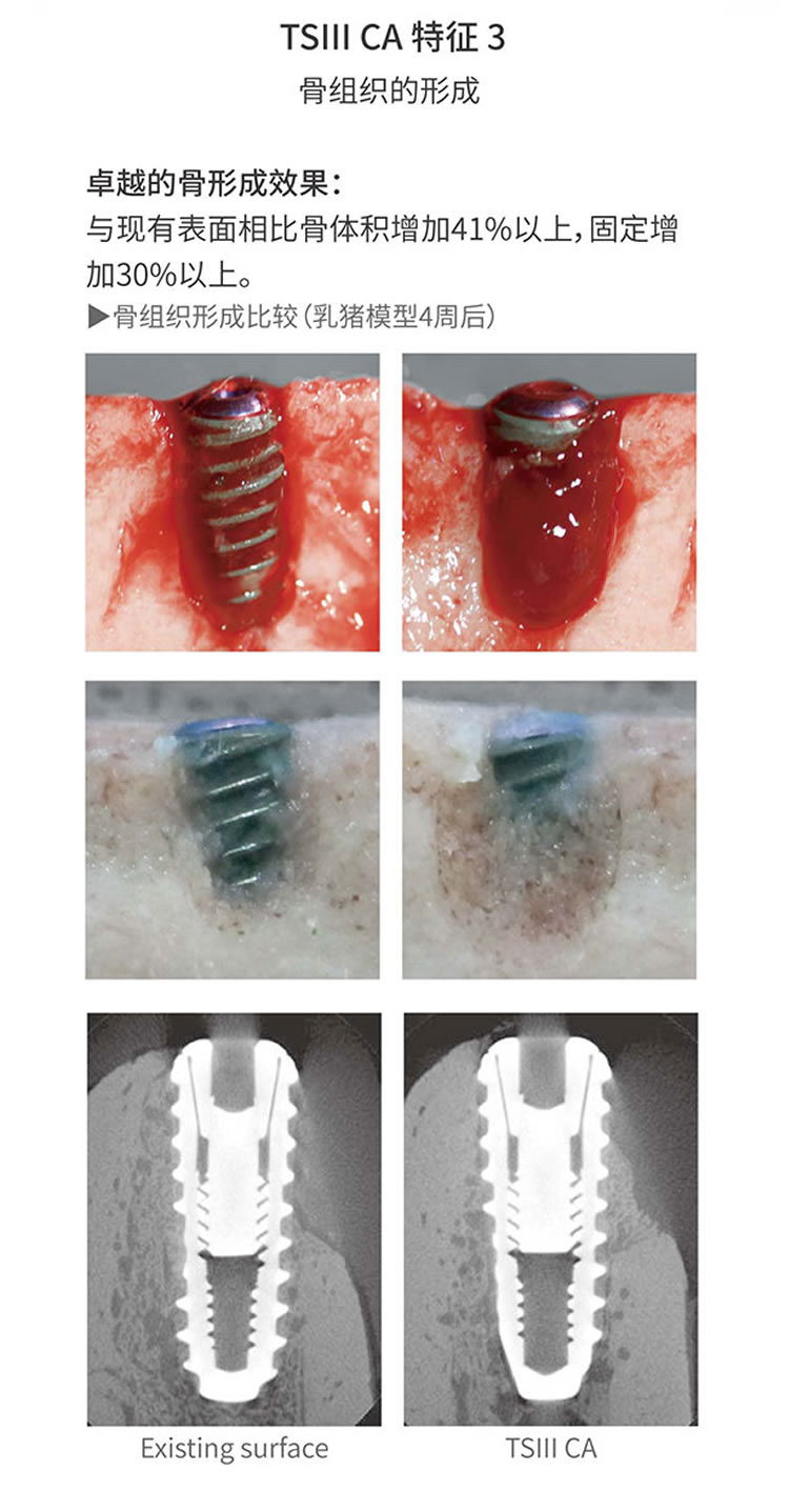 奥齿泰 TSIII CA 亲水种植体-_r3_c1.jpg