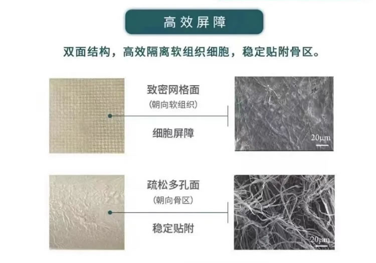 瑞拜欧 骨膜1_r3_c1.jpg 瑞拜欧 骨膜1_r3_c1.jpg
