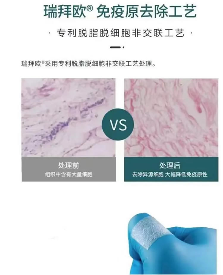 瑞拜欧 骨膜1_r2_c1.jpg 瑞拜欧 骨膜1_r2_c1.jpg