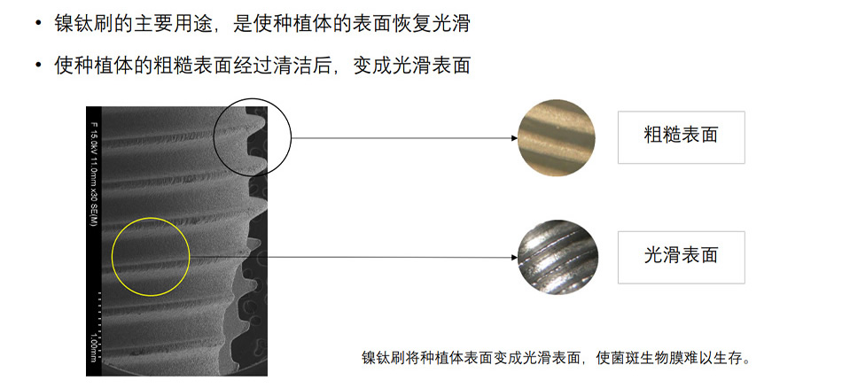钛刷_r2_c1.jpg 钛刷_r2_c1.jpg
