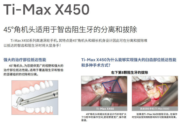 NSK Ti-Max X450 QD拔牙手机 不带灯 【 p1086】-1.jpg