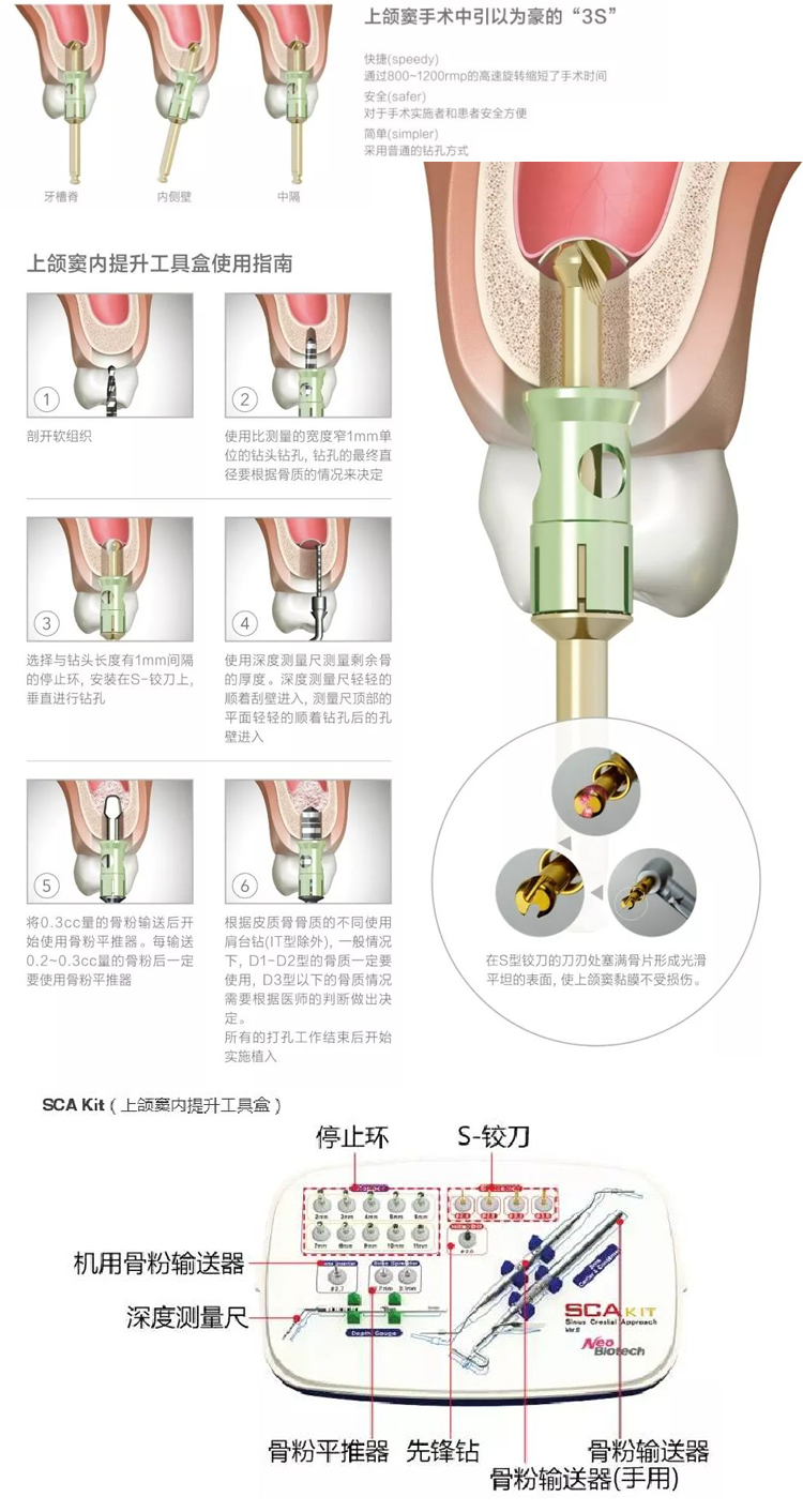 纽百特 上颌窦内提工具盒-1.jpg