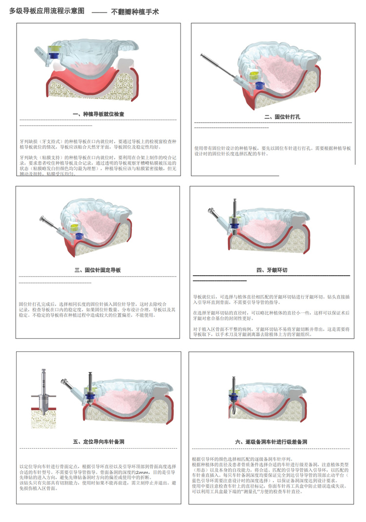 西科玛 全程导板工具盒-2_r3_c1.jpg