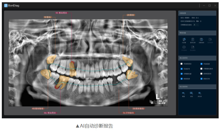 博爵CBCT系列详情-1_r9_c1.jpg