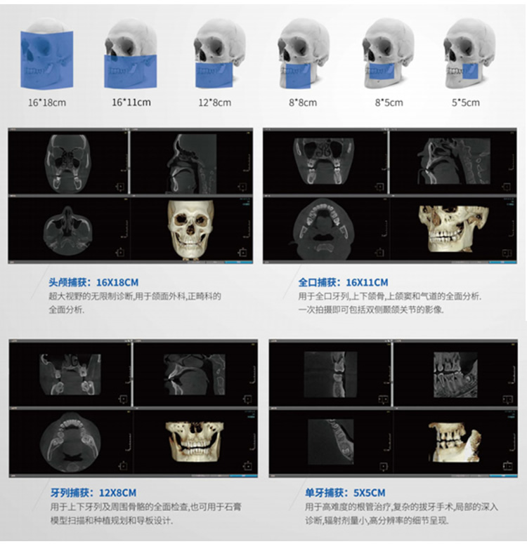 博爵CBCT系列详情-1_r4_c1.jpg