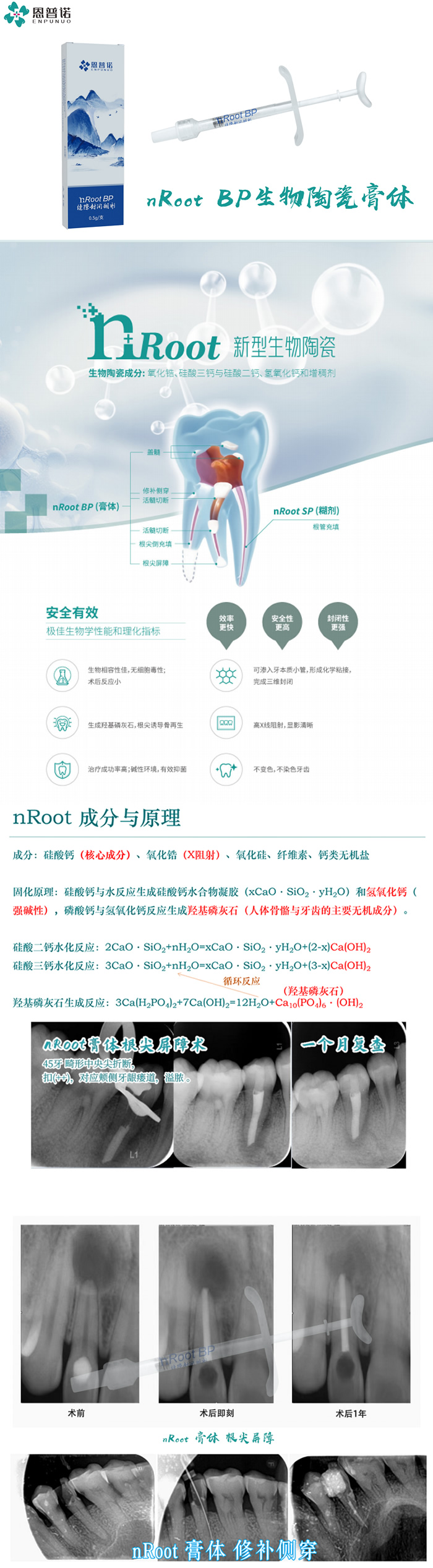 恩普诺   nRoot BP缝隙封闭糊剂1 .jpg