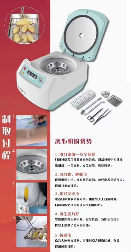 创英 离心机 TR18-1.jpg