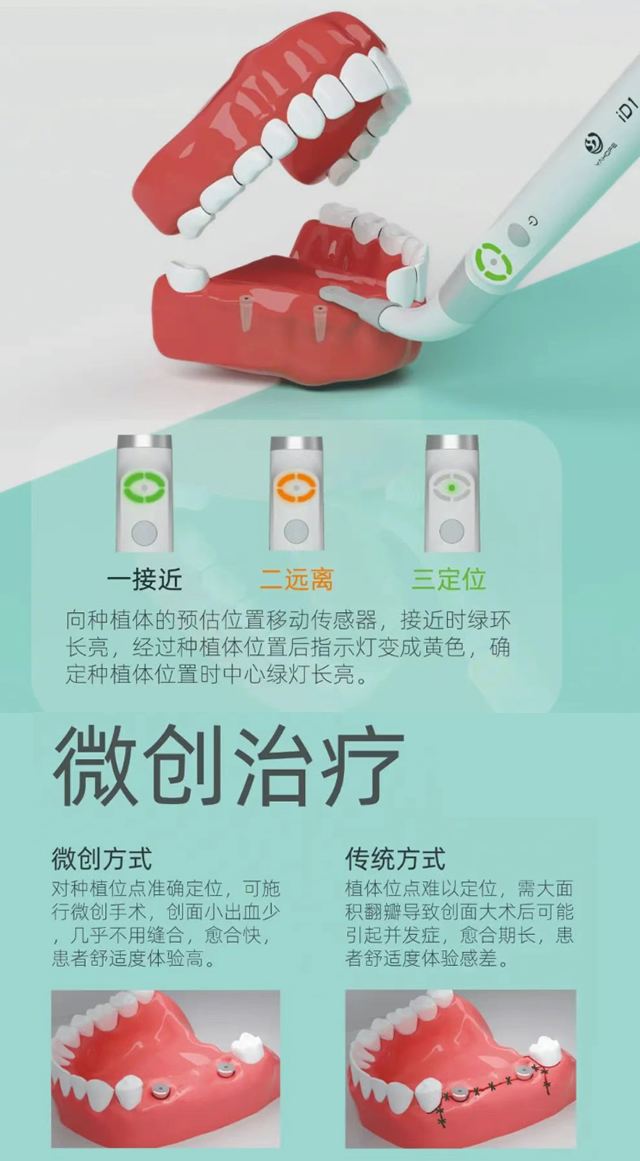 精工 种植定位仪-微创治疗仪iD1-2.jpg