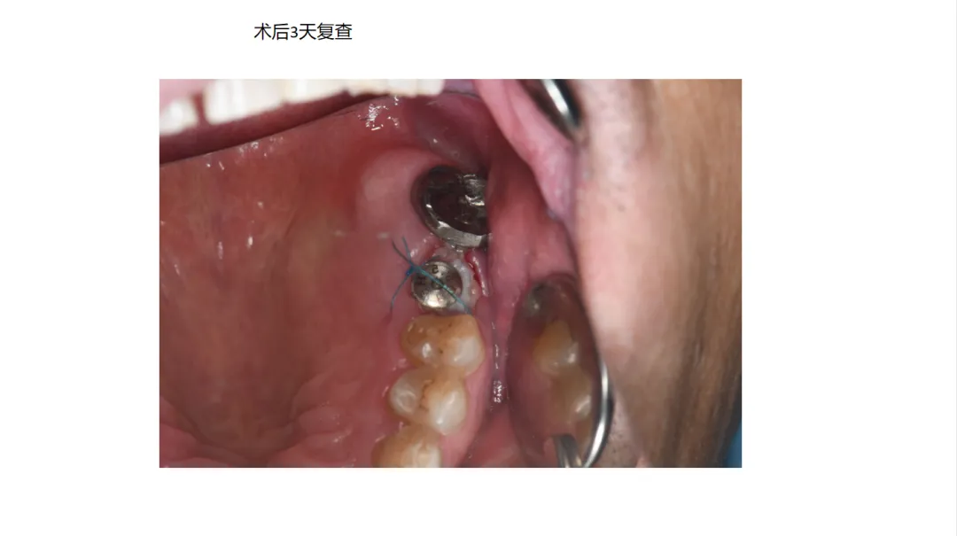 ece560fa-89ef-450d-abf7-d3d99221e6d6.png ece560fa-89ef-450d-abf7-d3d99221e6d6.png