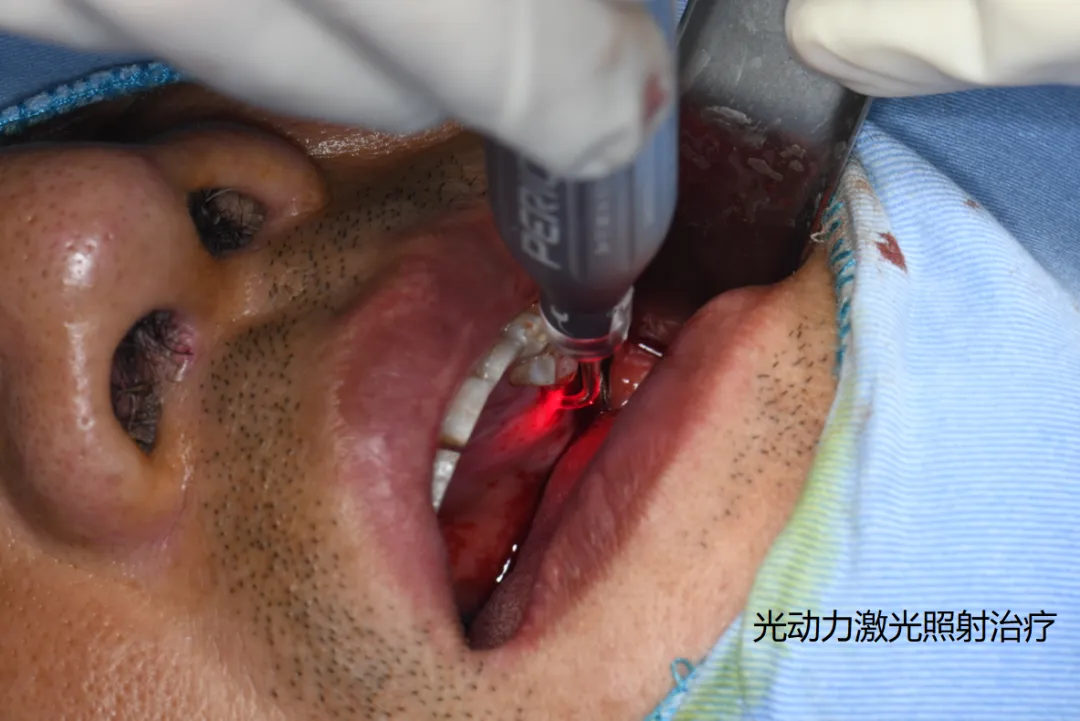 94d3d114-d02a-43b4-9823-fdec71d5e5bd.png 94d3d114-d02a-43b4-9823-fdec71d5e5bd.png