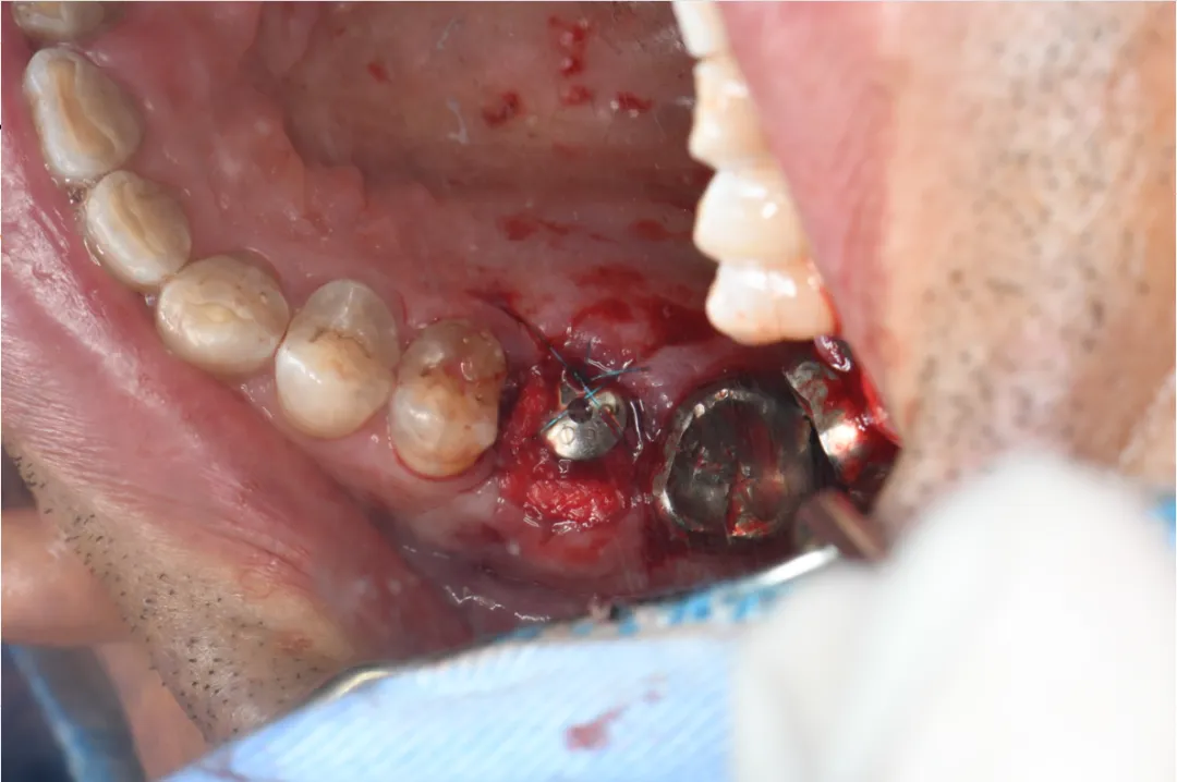 c7fdc4f6-25b6-4fca-b5bd-73390e6dc5bb.png c7fdc4f6-25b6-4fca-b5bd-73390e6dc5bb.png