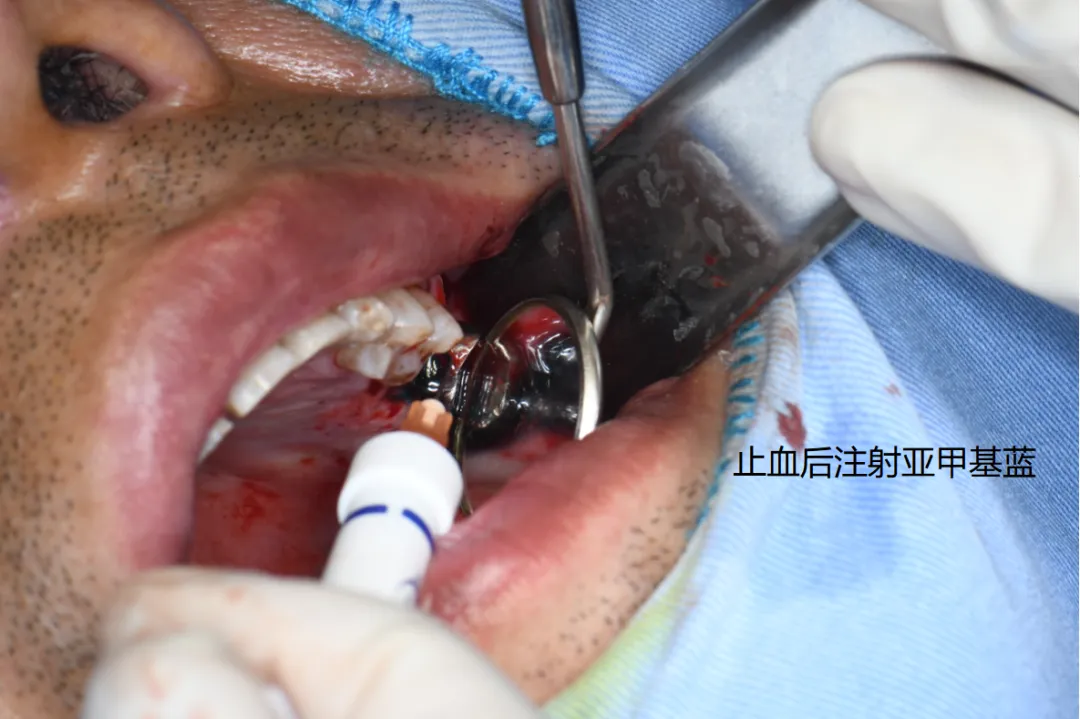 48d52f28-6d14-443b-a7ad-b6b9047b830c.png 48d52f28-6d14-443b-a7ad-b6b9047b830c.png