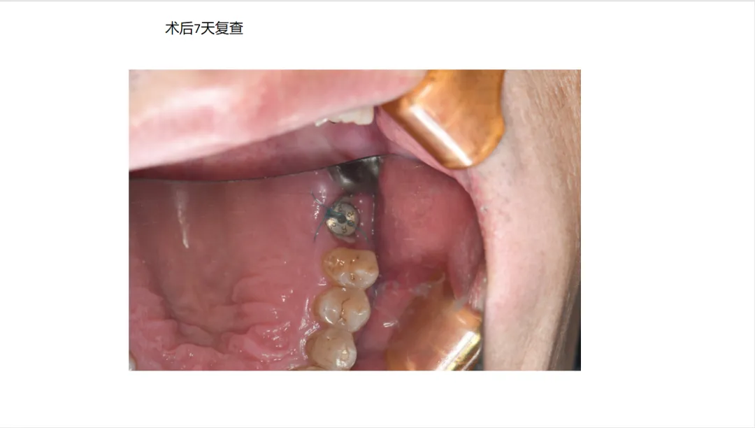 83f4f0f4-0d9d-43f1-876c-04634f46411d.png 83f4f0f4-0d9d-43f1-876c-04634f46411d.png