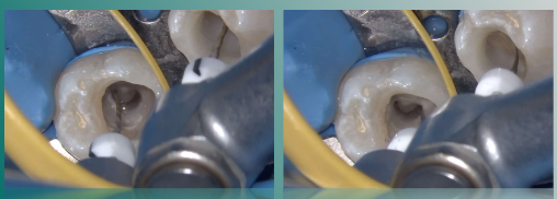 74ad1f84b6a298f4946dcb1b46e314c9.png 74ad1f84b6a298f4946dcb1b46e314c9.png