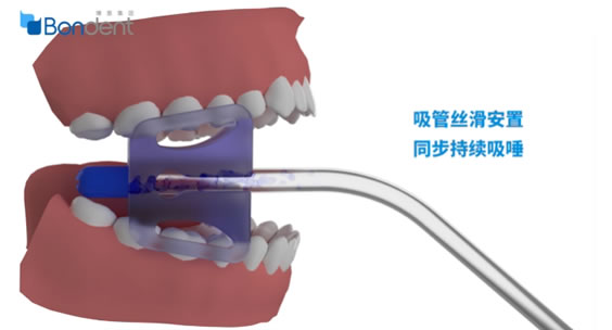 挡舌板7.jpg 挡舌板7.jpg
