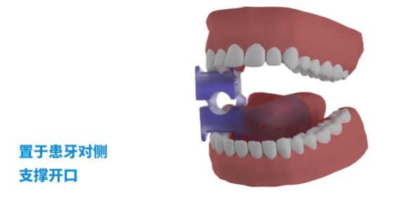 挡舌板3.jpg 挡舌板3.jpg