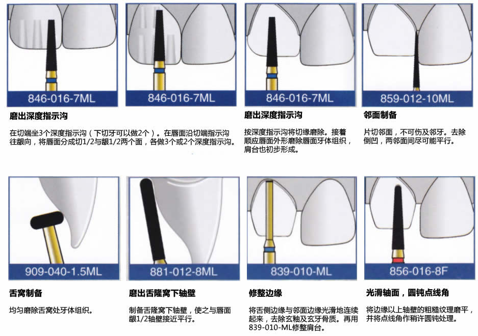 前牙使用方法