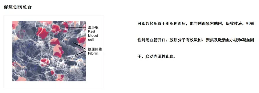 可即邦 医用胶原蛋白海绵3.webp 可即邦 医用胶原蛋白海绵3.webp