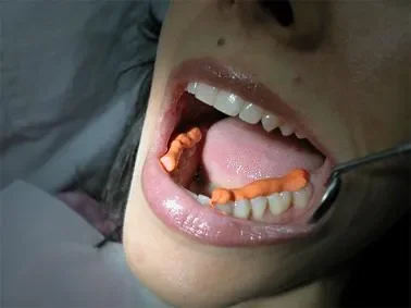 临床操作步骤