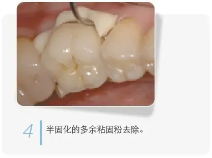 image.webp