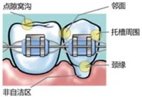 义获嘉 氟齿乐 义获嘉 氟齿乐