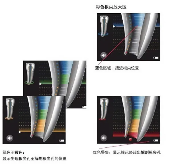 VDW RAYPEX 6 根尖定位仪 新款 VDW RAYPEX 6 根尖定位仪 新款
