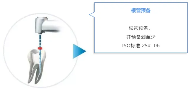 VDW EDDY 声波荡洗工作尖b.webp