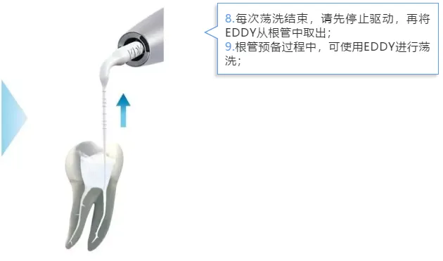 VDW EDDY 声波荡洗工作尖f.webp