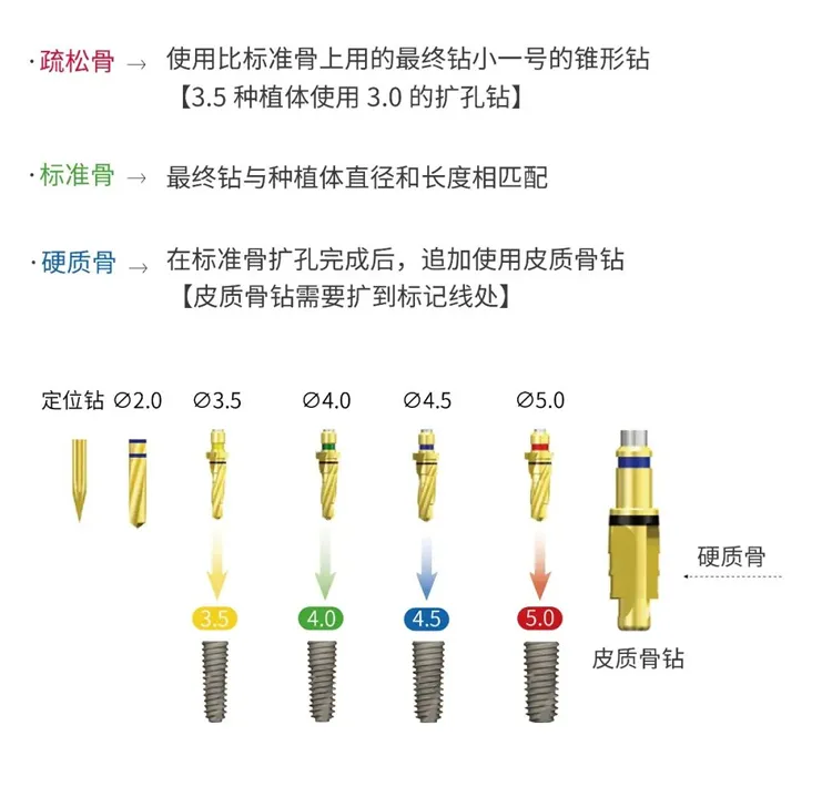 奥齿泰 锥形工具盒Taper KIT（OTSK）-1.webp