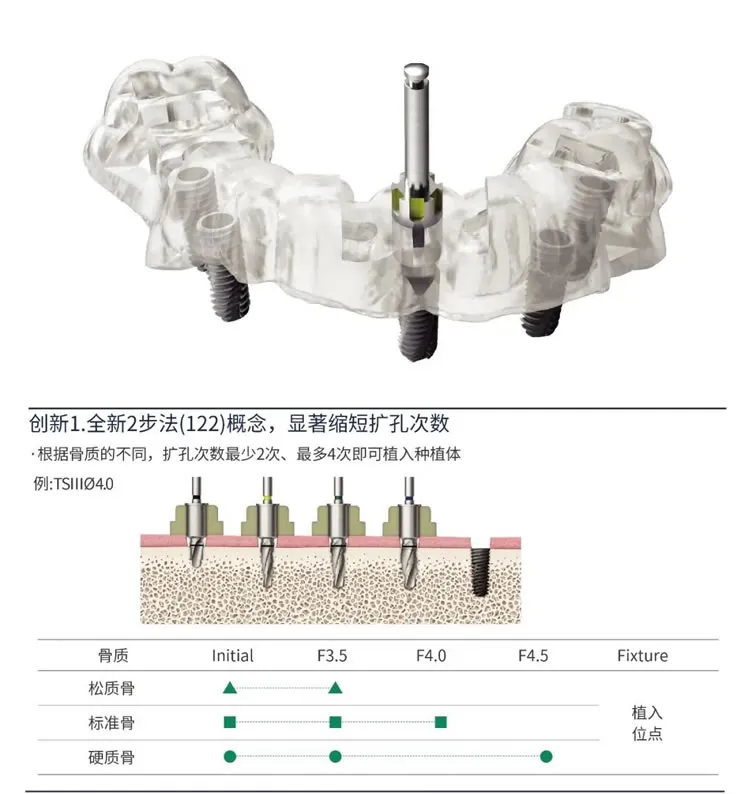 奥齿泰  导板工具盒  One Guide KIT-1_r1_c1.webp