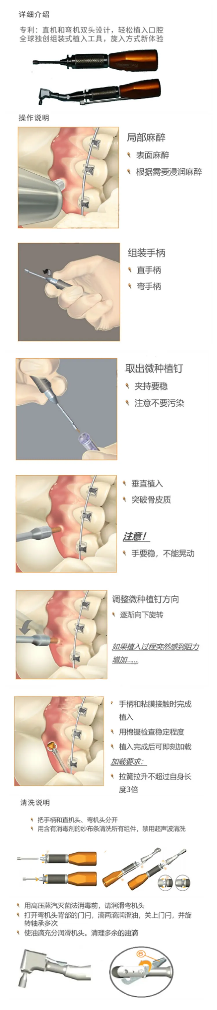 奥美科 Vector TAS支抗钉扳手.webp